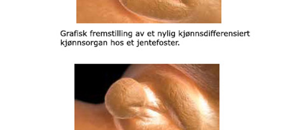 Kjønnsdifferensiering i fosterstadiet (2)